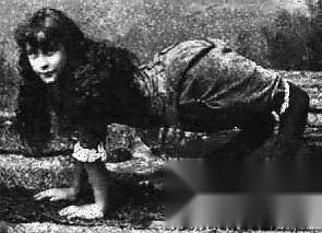 Đây là đoạn trích từ tờ rơi quảng cáo cho buổi trình diễn nhào lộn của Ella Harper: 'Tôi được gọi là Cô gái lạc đà vì đầu gối của tôi đi ngược chiều nhau và như bạn có thể thấy trong hình, tôi có thể sử dụng tay và chân của mình để đi lại trong 4 năm rưỡi qua. Tôi đã đi lưu diễn nhiều nơi với một đoàn nhào lộn và bây giờ, vào năm 1886, tôi có ý định từ bỏ sự nghiệp nhào lộn của mình và chuyển sang học tập để phù hợp với một nghề nghiệp khác'.