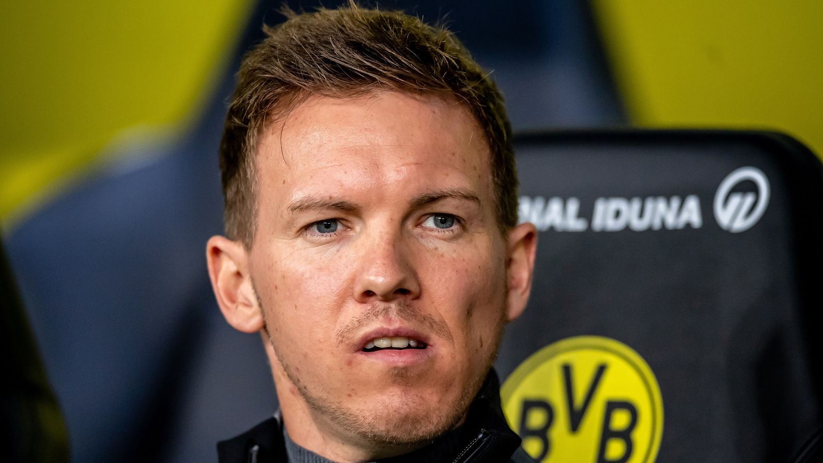 skysport-de-nagelsmann-bvb-5230383-1709194294.jpg