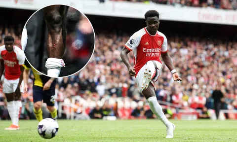 NHM Arsenal phẫn nộ với hình ảnh Saka bị kê chân và đối thủ thoát thẻ