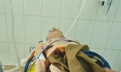 Đi theo ông Thích Minh Tuệ, một người đàn ông không qua khỏi do sốc nhiệt