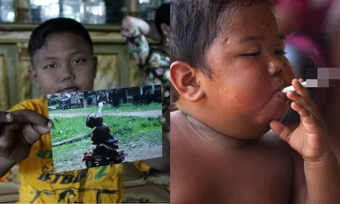 Cậu bé 2 tuổi hút 40 điếu thuốc/ngày khiến cả thế giới kinh ngạc bây giờ thế nào?