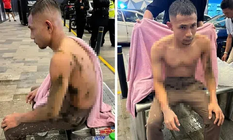 SỐC: Ngôi sao số 1 ĐT Malaysia bị kẻ lạ mặt tạt axit