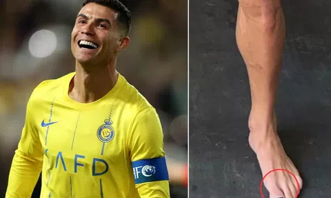 Lý do khiến Ronaldo và Mike Tyson đua nhau sơn móng tay