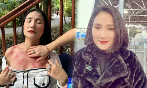 MC Cát Tường gặp sự cố sức khỏe khi ở nước ngoài