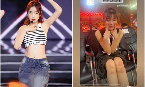 Trước giờ G chung kết Miss Grand Vietnam 2023: Lona Kiều Loan bị bầm dập, Chi Pu khoe eo thon khi tổng duyệt