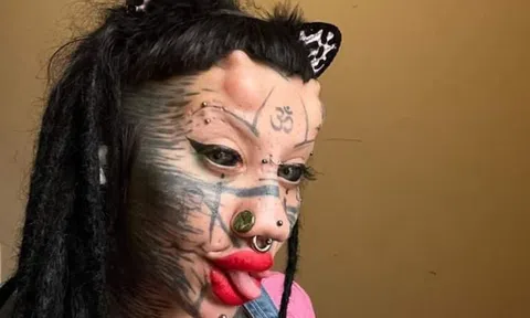 Cô gái 10X phẫu thuật thẩm mỹ 20 lần để thực hiện ước mơ 'biến hình' thành.... mèo