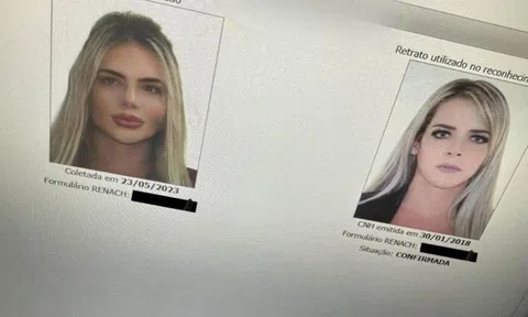 Cựu luật sư chi 300.000 USD để dao kéo gặp sự cố khi gia hạn giấy phép lái xe vì ngoại hình quá khác lạ