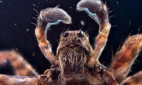 Đi du lịch kỷ niệm ngày cưới, người đàn ông bị 'thợ săn mồi 8 chân' đẻ trứng vào ngón chân gây mưng mủ