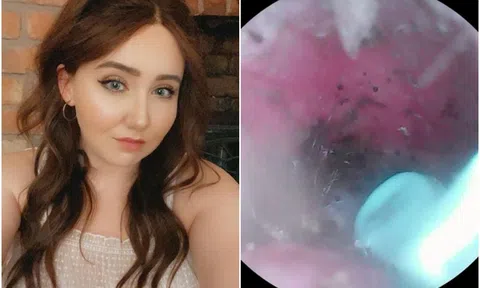 Nghe tiếng lách cách trong tai, đi khám mới phát hiện 'quái vật tám chân' làm tổ bên trong