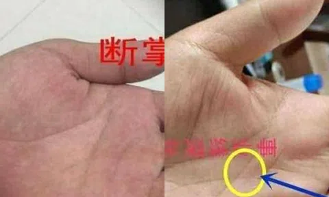 Hình chỉ tay này xuất hiện trong lòng bàn tay, xin chúc mừng! Đây chính là biểu tượng của sự giàu có!