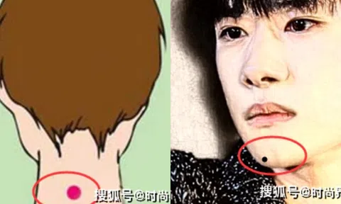 5 vị trí nốt ruồi tài lộc, nếu sở hữu sẽ có số phát tài, tuyệt đối đừng xoá!