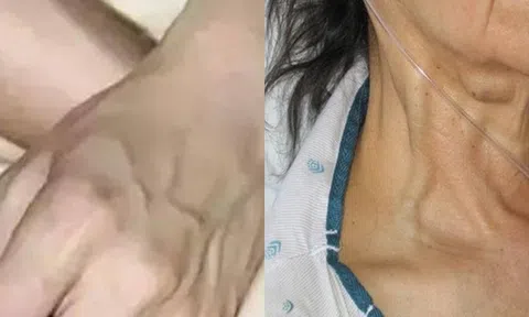 Trên tay càng nhiều gân thì càng... Phụ nữ nhất định phải xem điều này!