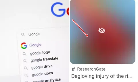 Top những từ không bao giờ nên tra Google nếu không muốn bị ám ảnh cả đời!
