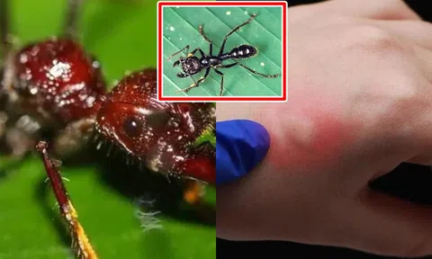 Loài kiến ​​độc nhất thế giới, ai bị cắn thì có cảm giác như bị đạn bắn!