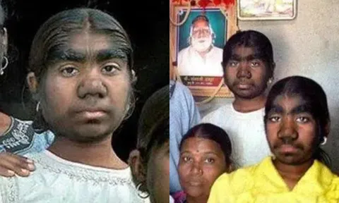 Ngôi làng duy nhất trên thế giới có hơn 200 người giống nhau y hệt, lý do đằng sau là ẩn số