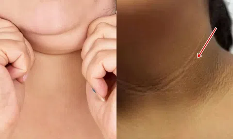 Một người có thể sống được bao lâu nếu nhìn vào cổ mình? Những người có tuổi thọ cao thường có những đặc điểm này ở cổ!