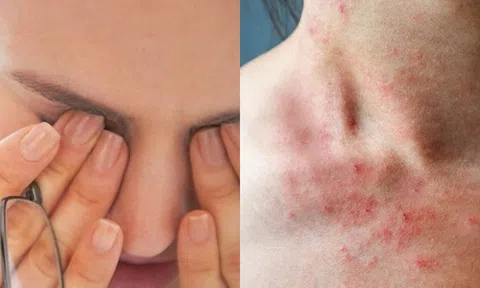 Ngứa 2 bộ phận này trên cơ thể, đừng nhầm là dị ứng, có thể là tín hiệu của ung thư gan