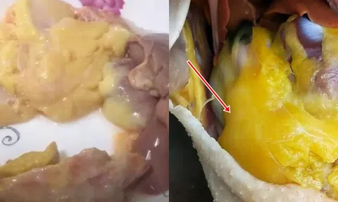 Khi làm thịt gà, nếu thấy miếng ‘bơ vàng’ này thì đừng dại gì mà vứt đi!