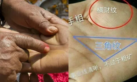 Nếu có hình tam giác trong lòng bàn tay, tương lai bạn sẽ giàu có đến 99%?