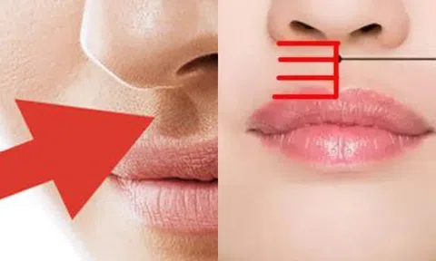 Chỉ cần nhìn 1 chỗ dưới mũi là biết ngay khả năng sinh sản có tốt hay không!