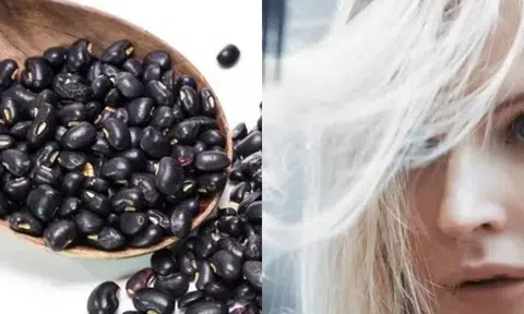 Lông ở bộ phận này trên cơ thể chuyển sang màu trắng, có thể là dấu hiệu nguy hiểm , mong bạn không mắc phải