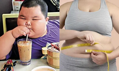 Thế giới có bao nhiêu người béo phì? Con số sẽ khiến bạn phát hoảng!