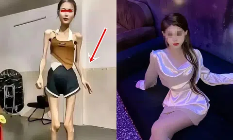 Cô gái chỉ ăn một bữa mỗi tuần để giảm cân, cư dân mạng phẫn nộ khi so sánh ảnh ‘trước-sau’