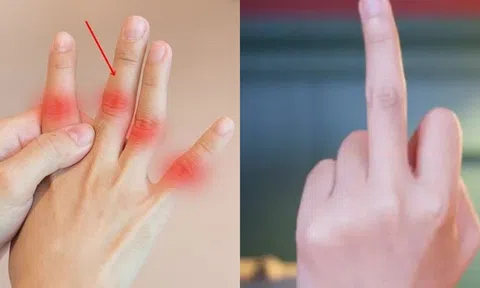 ‘Ngón giữa’ có 3 biểu hiện này,  thì gan của bạn đang hoạt động rất tốt