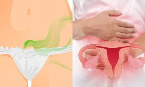 Tại sao 'cô bé’ lại có mùi lạ khi quan hệ? Cẩn thận nguy hiểm đằng sau!