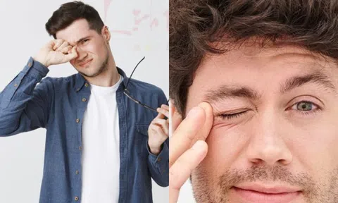 Sự thật khi mắt phải của đàn ông hay giật: Điềm báo sắp giàu?