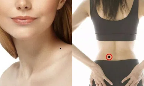 Phụ nữ có nốt ruồi ở 3 điểm này sẽ có số phận sung sướng, viên mãn?