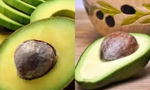 Tại sao không nên ăn quá nhiều bơ? Những điều cấm kỵ cần phải biết!