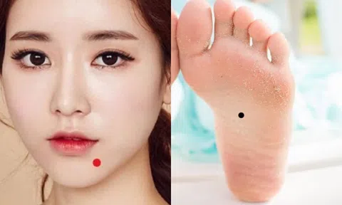 4 nốt ruồi may mắn nhất trên cơ thể, ẩn chứa vàng bạc!