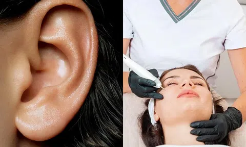 Nếu có nốt ruồi ở 4 nơi này thì đừng dại mà xóa đi nếu không sẽ mất phúc và gặp hoạ!