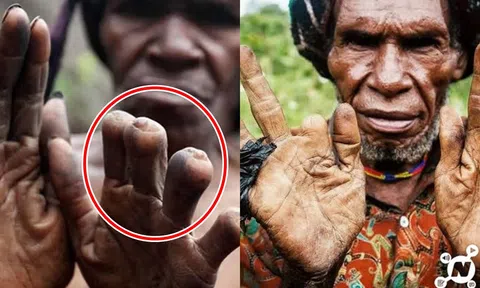 Bộ tộc có thủ tục rùng rợn: Phụ nữ phải cắt cụt ngón tay khi người nhà mất, càng thân thiết càng mất nhiều ngón!