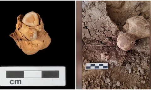 Phát hiện khối u có răng hiếm gặp trong lăng mộ Ai Cập từ 3.000 năm trước