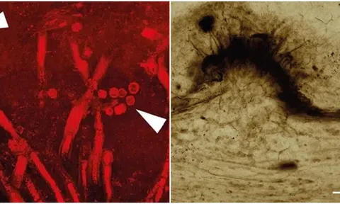 Loại nấm kí sinh lâu đời nhất được phát hiện trong thực vật hóa thạch bị đóng băng 400 triệu năm trước