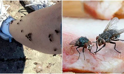Lý do bất ngờ khiến ruồi thích bám vào người dù không hút máu hay cắn thịt