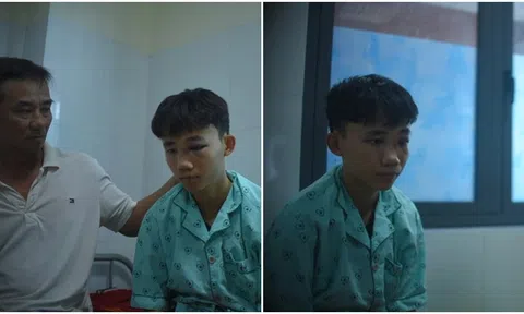 Vụ nam sinh bị 10 bạn cùng trường đánh gãy mũi phải cấp cứu: Đã từng bị đánh và muốn nghỉ học