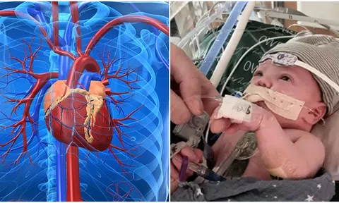 Bé trai ghép tim 1 phần đầu tiên trên thế giới phát triển diệu kì sau hơn 1 năm