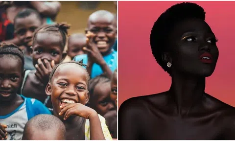 Tại sao người da đen lại có làn da tối màu như vậy? Nắng nóng không phải lý do duy nhất