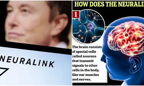 Chip não lần đầu tiên được cấy ghép vào người gây tranh cãi