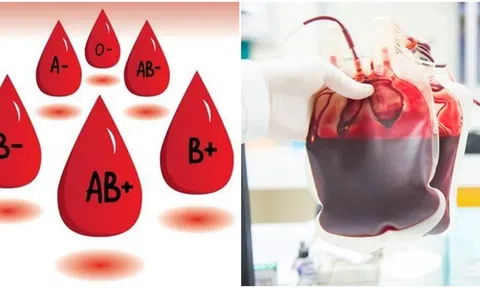 Nhóm máu hiếm nhất là nhóm máu nào? Chỉ 50 người trên thế giới sở hữu nhóm máu này