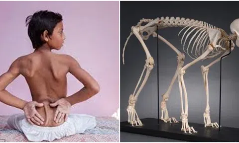 Hé lộ lý do con người mất đuôi vào 25 triệu năm trước