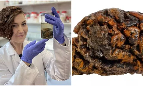 Hé lộ bí ẩn bộ não con người cực kì hiếm được bảo tồn từ 12.000 năm trước