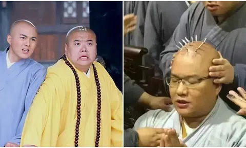 Vì sao các hòa thượng thời xưa có 9 vết sẹo tròn trên đỉnh đầu?