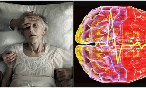 Sóng não của con người trước khi chết tiết lộ sự thật khủng khiếp