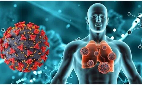 Người đàn ông mắc Covid lâu nhất thế giới: Kéo dài 613 ngày, chết vì mắc biến thể cực kì đột biến