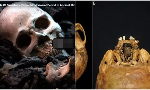 Hé lộ về 1 vật thể bất thường 'độc nhất vô nhị' trong hộp sọ từ thế kỉ 18