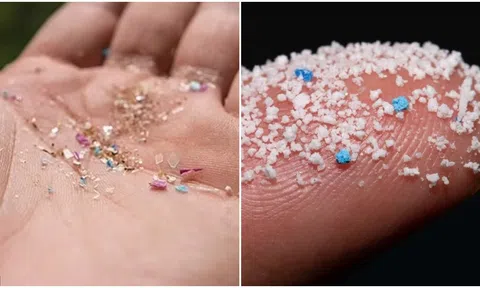 Top quốc gia người dân ăn và hít thở vi nhựa nhiều nhất thế giới, sững sờ vị trí của Việt Nam